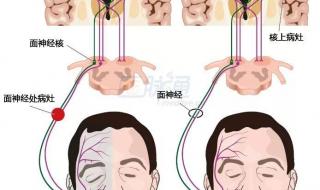 女子被冷风吹成面瘫 女子被冷风吹成面瘫